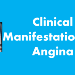 Clinical Manifestations of Angina