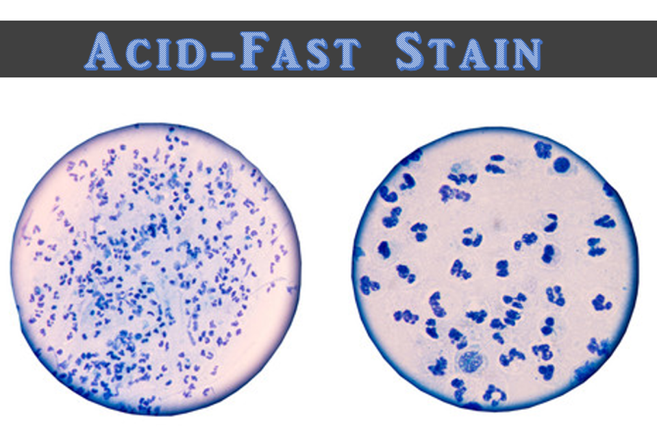 image 118 Acid-fast staining