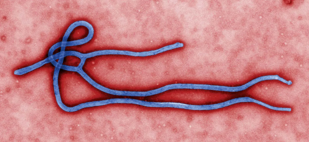 Ebola Virus Disease