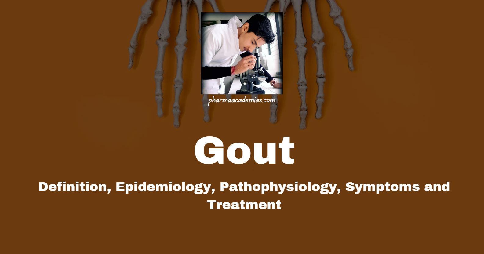 Read more about the article Gout: Definition, Epidemiology, Etiology, Symptoms and Treatment