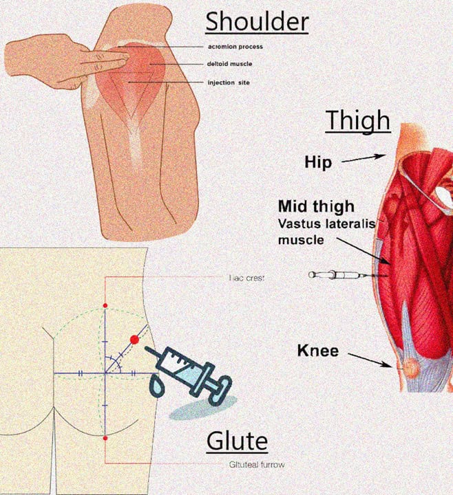 Intramuscular Absorption