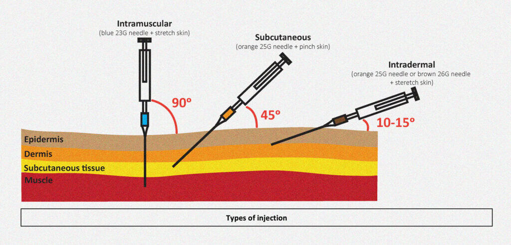 Transdermal Injection