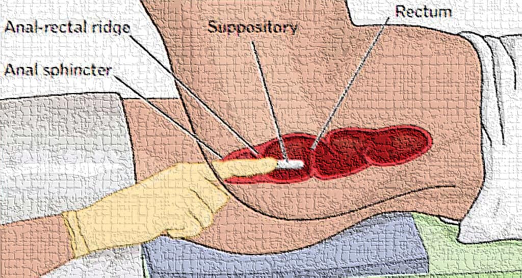 image 60 4 Absorption of Drugs from Non-Per-Oral Extravascular Routes