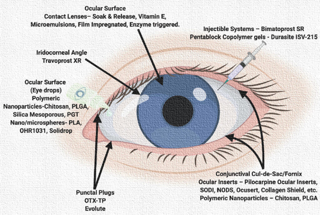 Ophthalmic drug delivery