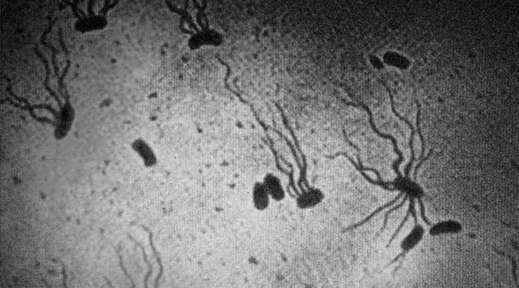 Typhoid Fever